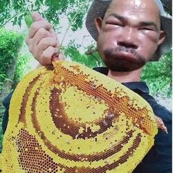 벌꿀 꿀벌 벌집 벌에 쏘인 얼굴